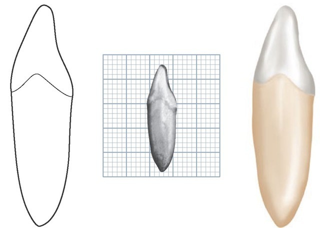 Mandibular right lateral incisor, mesial aspect. (Grid = 1 sq mm.)