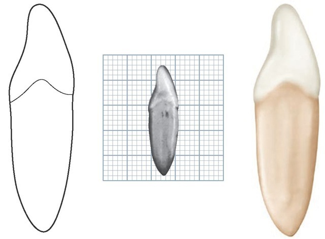 Mandibular right lateral incisor, distal aspect. (Grid = 1 sq mm.)