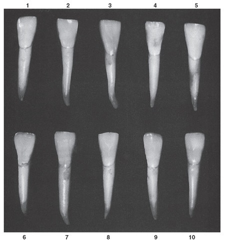 Mandibular lateral incisor, labial aspect. Ten typical specimens are shown.