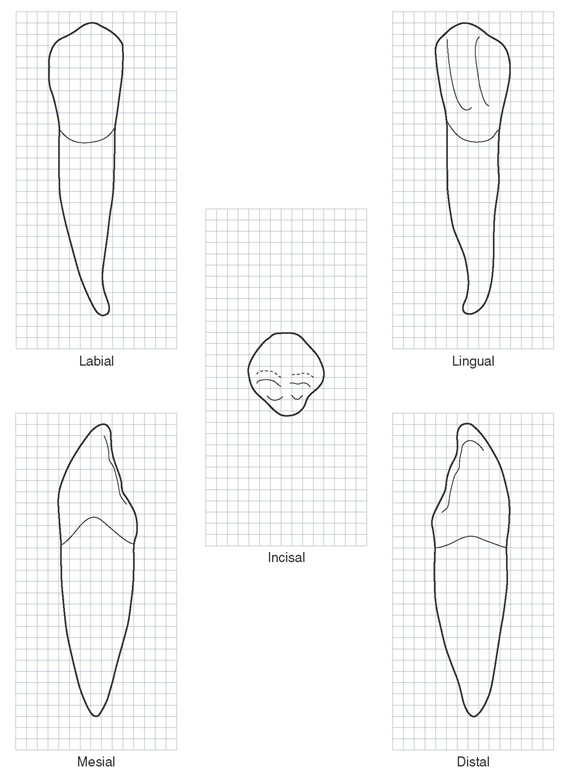 Mandibular right canine. Graph outlines of five aspects are shown. (Grid = 1 sq mm.)