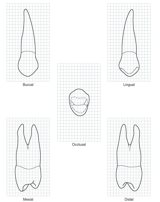 Maxillary right first premolar. Graph outlines of five aspects are shown. (Grid = 1 sq mm.)