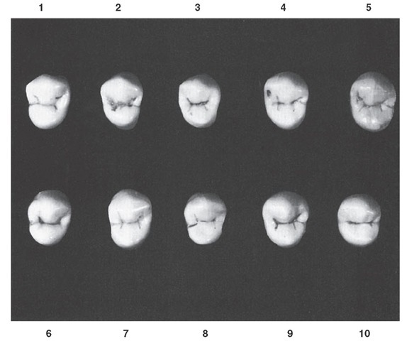 Maxillary first premolar, occlusal aspect. Ten typical specimens are shown.