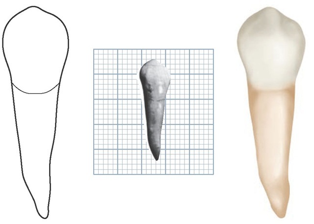 Mandibular right first premolar, buccal aspect. The specimen in this photograph shows a mesial inclination of the root. Mandibular premolars and canines have this tendency, although most of the roots of these teeth will curve, if at all, in a distal direction. (Grid = 1 sq mm.)