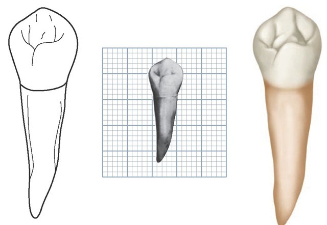 Mandibular right first premolar, lingual aspect. (Grid = 1 sq mm.)