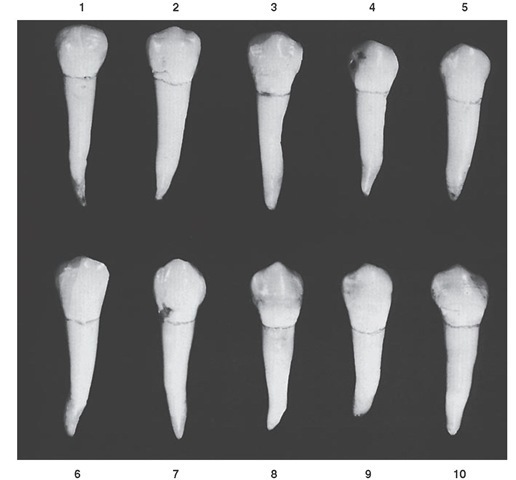 Mandibular first premolar, buccal aspect. Ten typical specimens are shown.