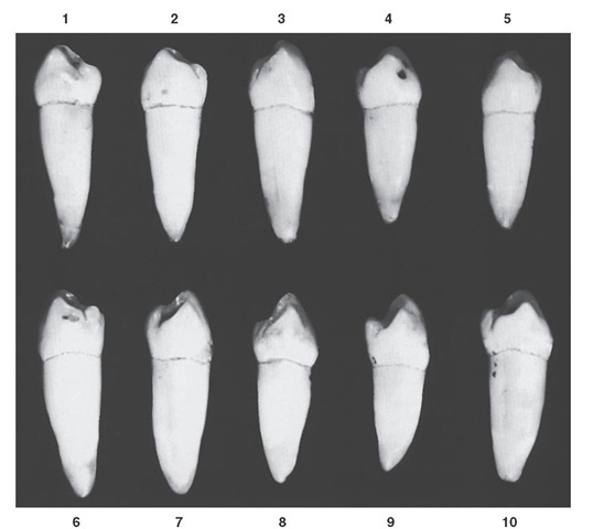 Mandibular second premolar, occlusal aspect. Ten typical specimens are shown.