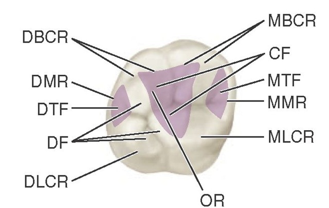 Maxillary right first molar, occlusal aspect. MBCR, Mesiobuccal cusp ridge; CF, central fossa (shaded area); MTF, mesial triangular fossa (shaded area); MMR, mesial marginal ridge; MLCR, mesiolingual cusp ridge; OR, oblique ridge; DLCR, distolingual cusp ridge; DF, distal fossa; DTF, distal triangular fossa (shaded area); DMR, distal marginal ridge; DBCR, distobuccal cusp ridge.