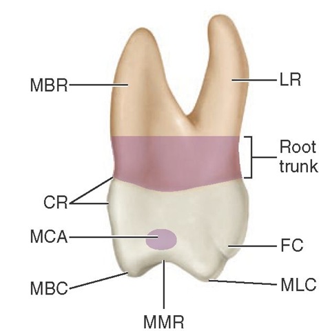 Maxillary right first molar, mesial aspect. LR, Lingual root; FC, fifth cusp; MLC, mesiolingual cusp; MMR, mesial marginal ridge; MBC, mesiobuccal ridge; MCA, mesial contact area; CR, cervical ridge; MBR, mesiobuccal root.