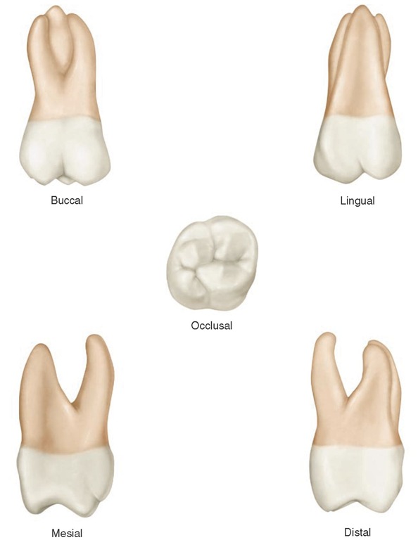 Maxillary right first molar.