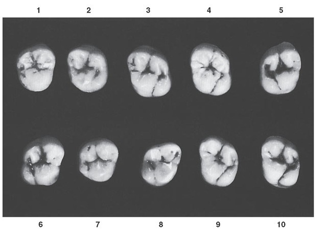 Maxillary second molar, occlusal aspect. Ten typical specimens are shown.