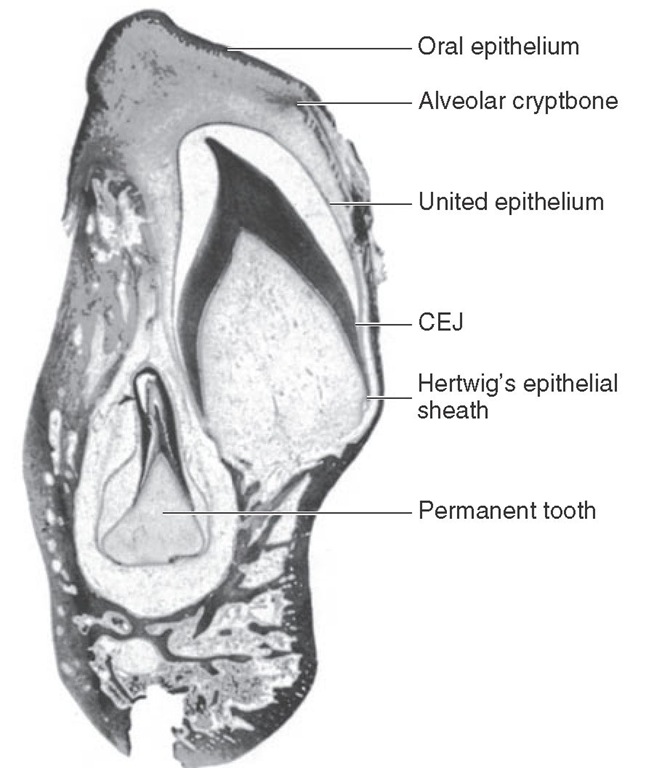 Section of mandible in a 9-month-old infant cut through an unerupted primary canine and its permanent successor, which lies lingually and apically to it. The enamel of the primary canine crown is completed and lost because of decalcification. Root formation has begun. CEJ, Cementoenamel junction.