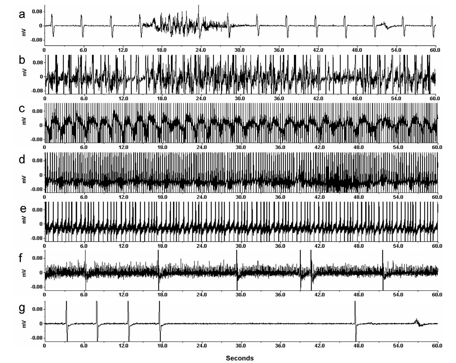 Electrocardiogram of an arctic ground squirrel at different core body temperatures during different phases of hibernation. 