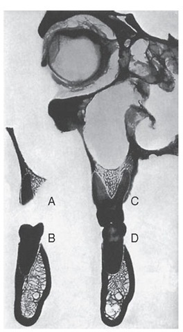First molar regions, showing relations of distobuccal root (A), distal half (B), and mesiobuccal (C) and lingual roots with mesial half of lower molar (D). 