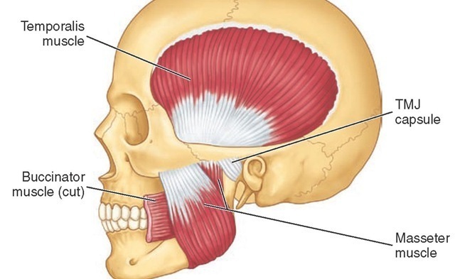 Masticatory muscles shown include the temporalis and masseter muscles. The deep masseter is attached to the zygoma (see Figure 15-17, C). TMJ, Temporomandibular joint. 
