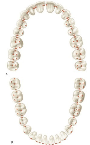 Idealized scheme for all contacts of supporting cusps with fossae and marginal ridges of opposing teeth. Such contact relations on all teeth are seldom found in the natural dentition. A, Maxillary arch. B, Mandibular arch. 