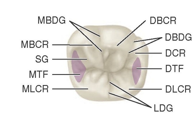  Mandibular right first molar, occlusal aspect. DBCR, Distobuccal cusp ridge; DBDG, distobuccal developmental groove; DCR, distal cusp ridge; DTF, distal triangular fossa (shaded area); DLCR, distolingual cusp ridge; LDG, lingual developmental groove; MLCR, mesiolingual cusp ridge; MTF, mesial triangular fossa (shaded area); SG, supplemental groove; MBCR, mesiobuccal cusp ridge; MBDG, mesiobuccal developmental groove. 