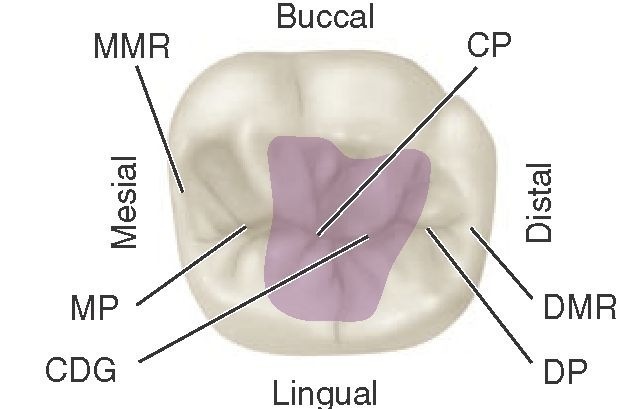Mandibular right first molar, occlusal aspect. Shaded area is the central fossa. CP, Central pit; DMR, distal marginal ridge; DP, distal pit; CDG, central developmental groove; MP, mesial pit; MMR, mesial marginal ridge. 