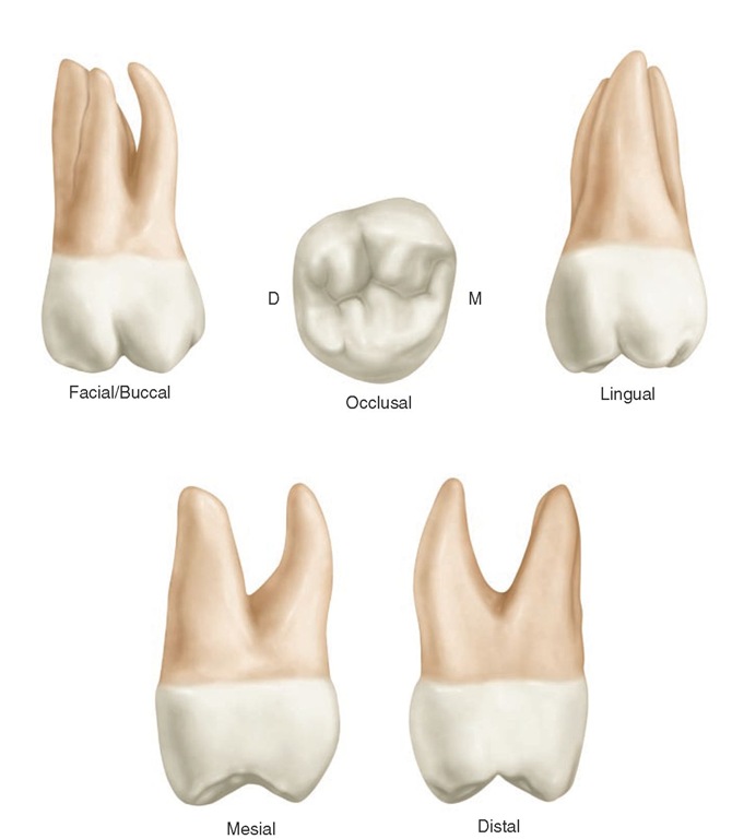 Maxillary second molar (right).