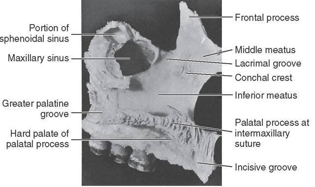 Medial view of left maxilla. 