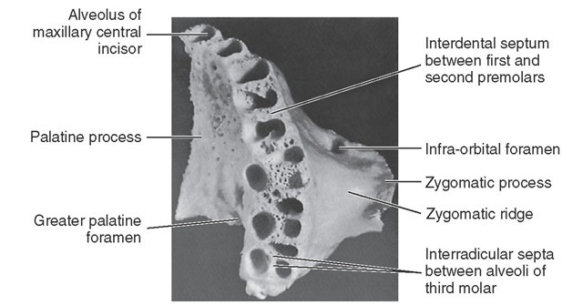 View of inferior surface of the maxilla showing alveolar process and alveoli. 