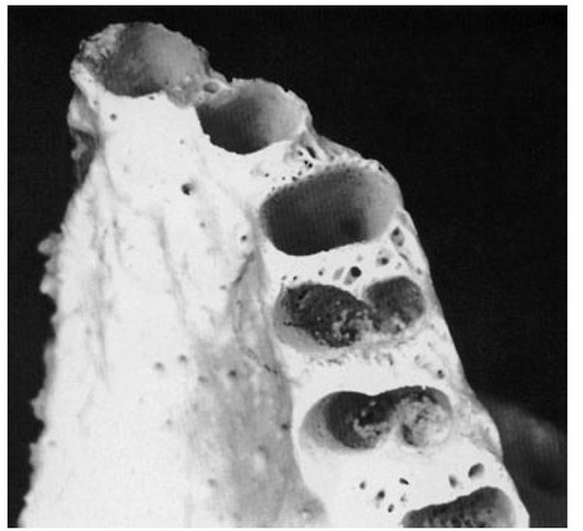 Alveoli of the premolar area. 