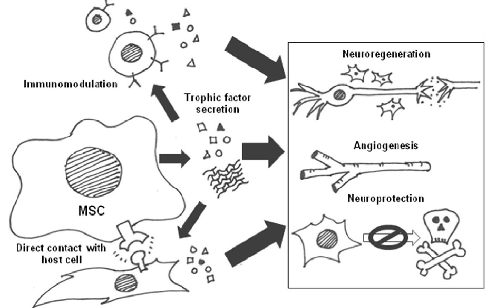 Summary of likely mechanisms of action for MSCs in the injured brain, highlighting the interconnectivity.