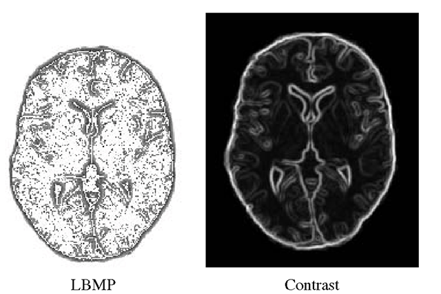 LBMP and Contrast images