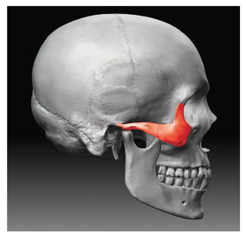 The angle and placement of the zygomatic bone 