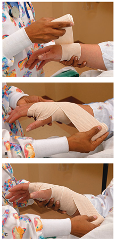 Wrapping the all cotton elastic (ACE) roller bandage on the client's arm. (A) Wrap the bandage around the client's limb twice, below the joint, to anchor it. (B) Use alternating ascending and descending turns to form a figure eight. (C) Overlap each turn of the bandage by one-half to two-thirds the width of the strip. Fasten the end securely.