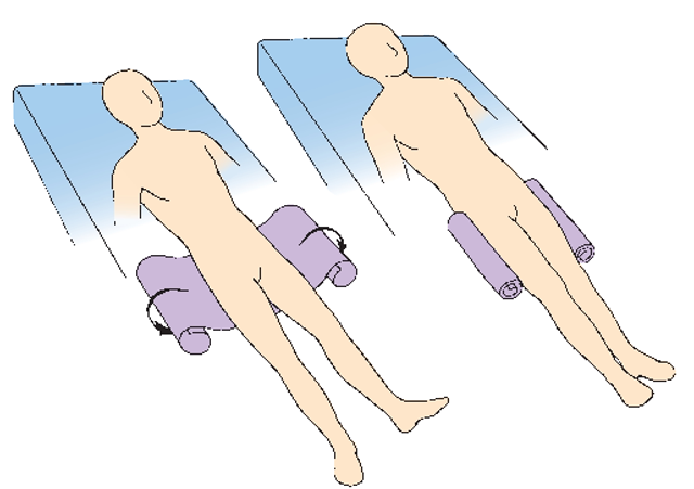 Placement of trochanter rolls to prevent outward rotation of the legs and hips. 