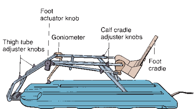 The continuous passive motion (CPM) machine. The goniometer measures the angle of the bend in the knee joint and controls the parameters of flexion and extension of the knee. Padding is added to protect the limb. 
