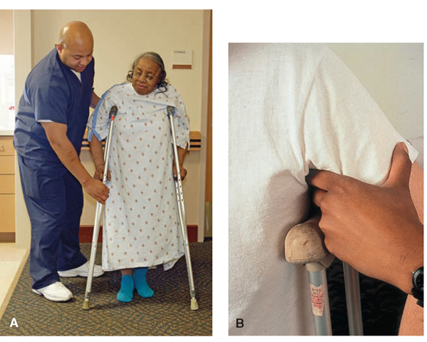 (A) Support the client until she is secure and safe in using crutches. (B) Fitting crutches to the client. Crutches should be adjusted so the client’s weight is borne on the hands. The crutch pads should not touch the axillae, and no weight should be borne on the tops of the crutches. 