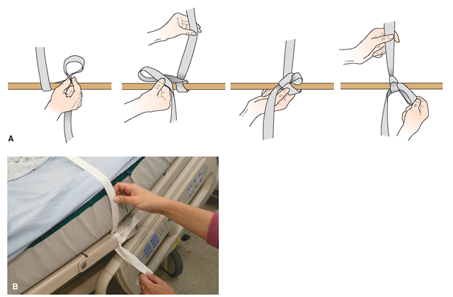  (A) This quick-release tie is made using an overhand knot, but slipping a loop (instead of the end of the strap) through the first loop. This must be used when securing any client safety device, for quick release in an emergency, (B) The straps are tied to the stationary portion of the bed frame, never to the side rails. 