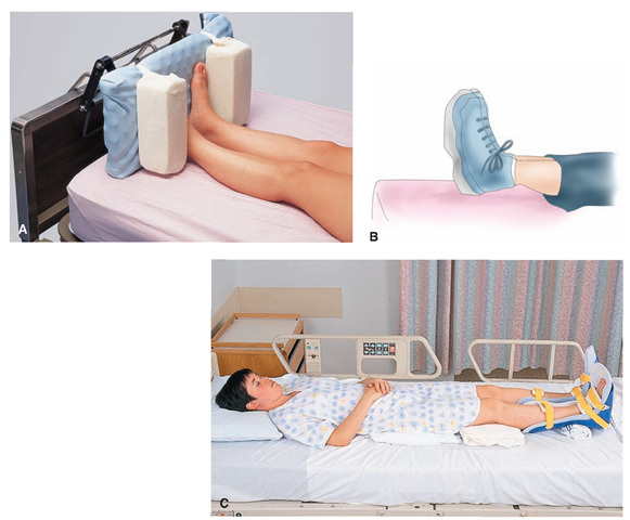 Prevention of foot-drop. (A) A padded footboard is placed at the foot of the bed. The padding helps prevent skin breakdown. The footboard keeps the feet in proper alignment (dorsiflexion). (B) High-top shoes are an alternative to the footboard, particularly if the person moves about in bed a great deal. (C) Protective boots (foot splints) are also available to prevent footdrop. 