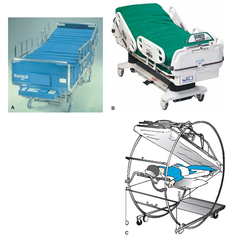 Many specialized beds are available to enhance client care and prevent deformities. These beds also make it easier for the nurse to care for the client who is seriously ill or disabled and to provide greater safety to the client. (A) This microcomputerized bed not only greatly lessens the possibility of pressure area development, but also manages incontinence in the immobile client. It provides drainage for body fluids into the receptacle at the foot of the bed, where it can be measured. It also provides a scale and a heater and has a quick-release mechanism for cardiopulmonary resuscitation (CPR). Some beds also have a cleansing and vacuuming system for skin care. (B) The TheraPulse ATP alternating pressure bed rotates air pockets, to reduce the possibility of developing pressure areas. (C) The Circ-O-Lectric or circle bed turns the client from front (prone) to back (supine), rotating around the feet.