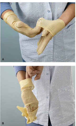 Safe removal of gloves. (A) Touch only the outside of the contaminated glove (inside a folded-down cuff) with gloved fingers. (B) Touch the skin only with bare fingers. Roll gloves together; with contaminated areas inside the roll and discard appropriately. Wash hands carefully