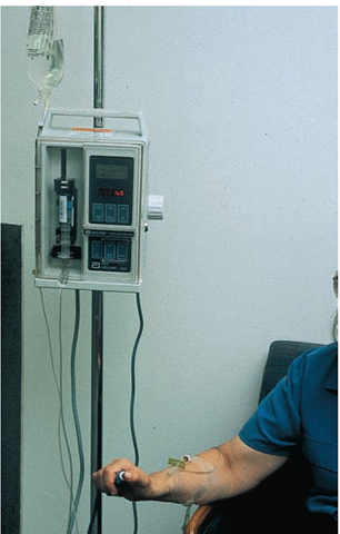 A patient-controlled analgesia (PCA) pump allows clients to administer their own analgesia. Many are smaller and easier to carry around if the client is ambulatory