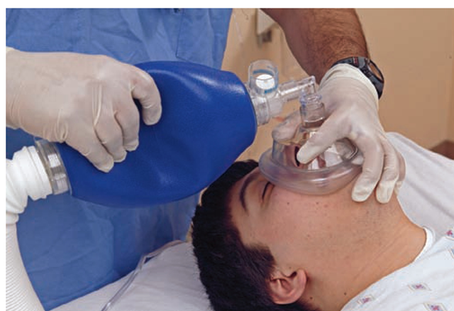 The use of an AMBU-bag replaces mouth-to-mouth resuscitation. Wear gloves whenever possible.
